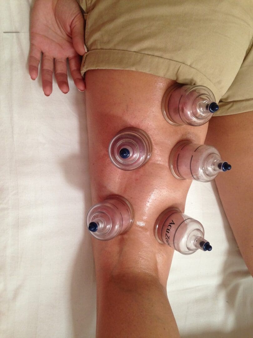 A person with many bottles in their legs